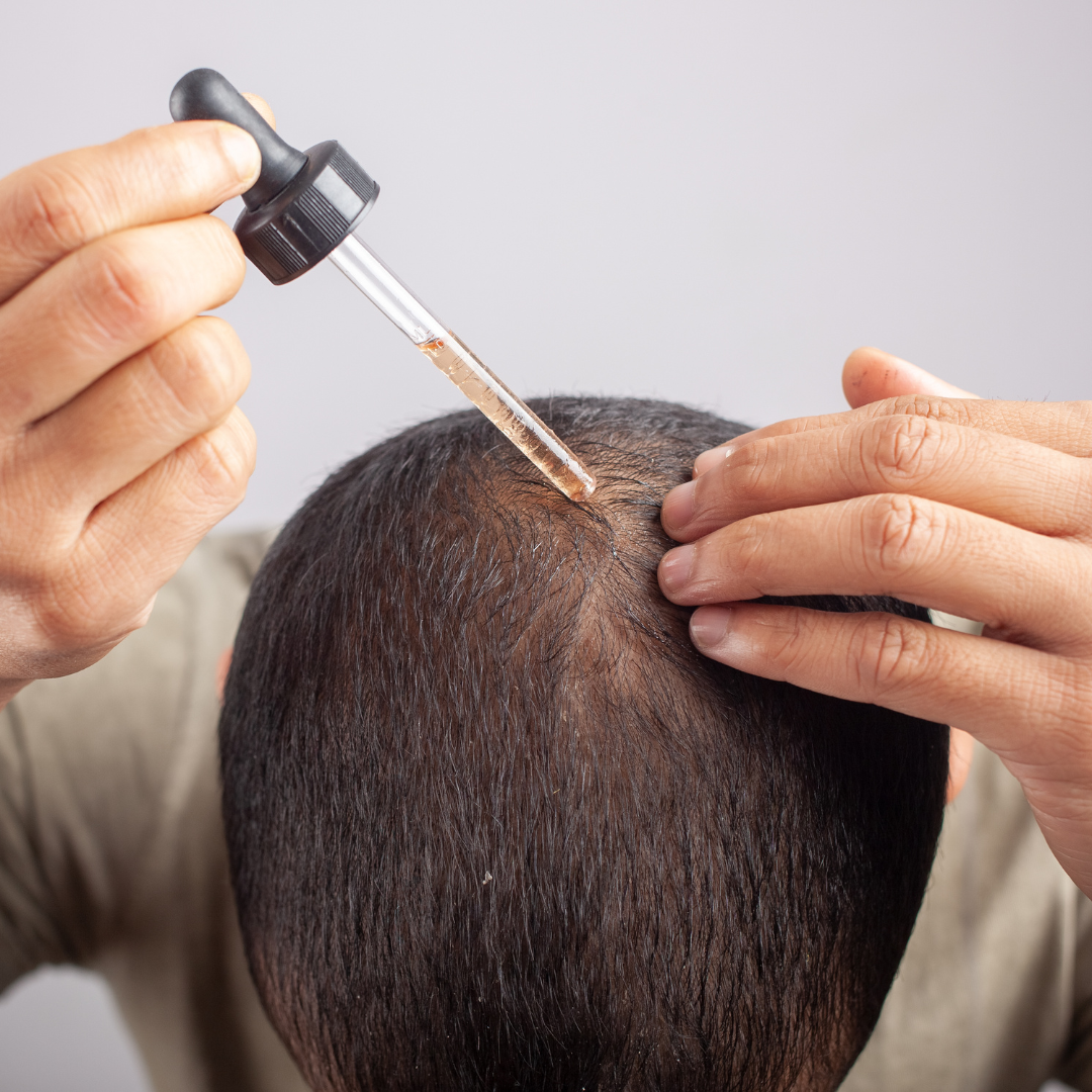 Minoxidil et repousse des cheveux