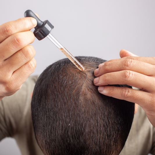 Minoxidil : Miracle pour la Repousse des Cheveux ?